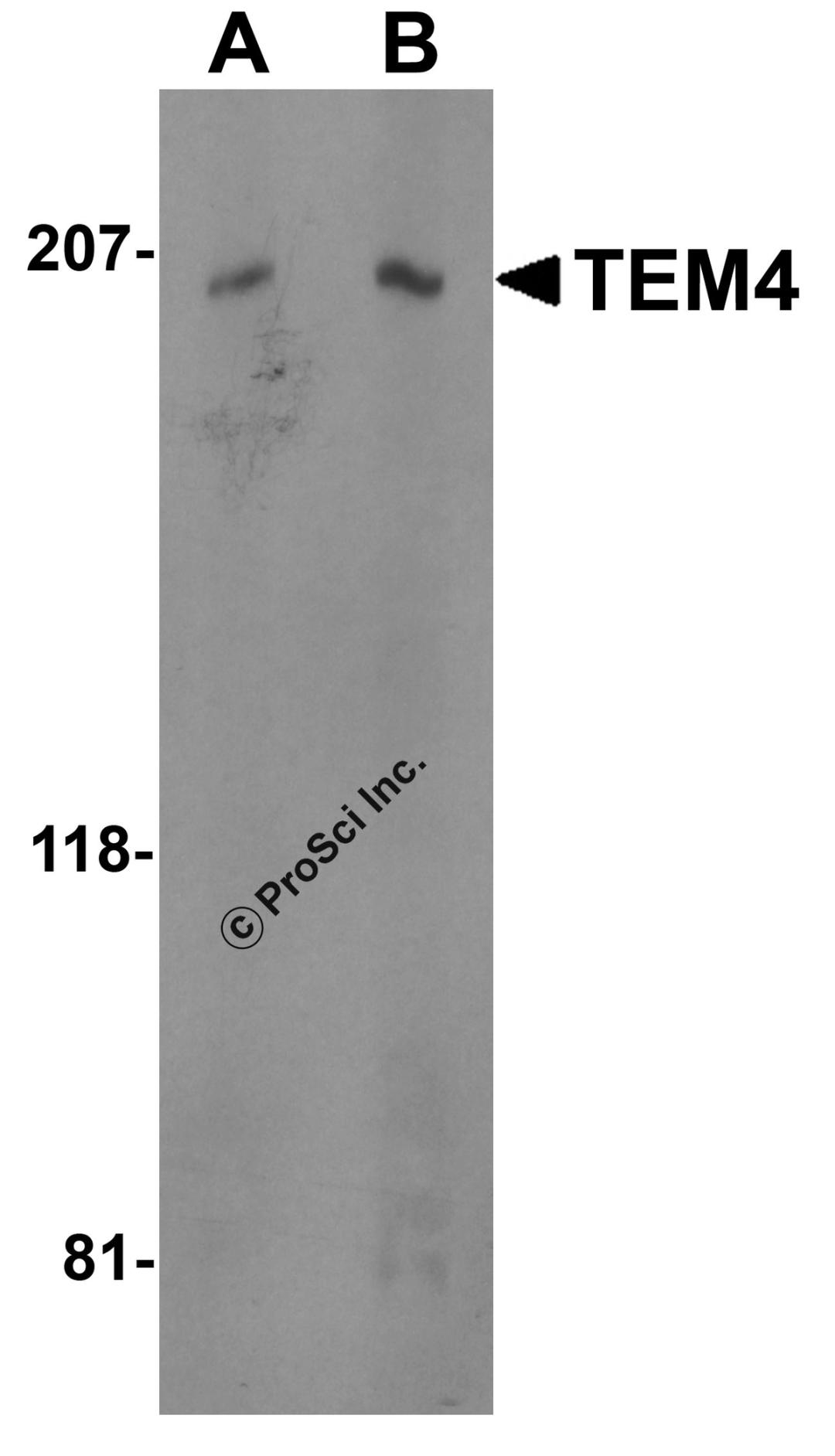 Western blot analysis of TEM4 in Jurkat cell lysate with TEM4 antibody at (A) 0.5 and (B) 1 μg/mL.