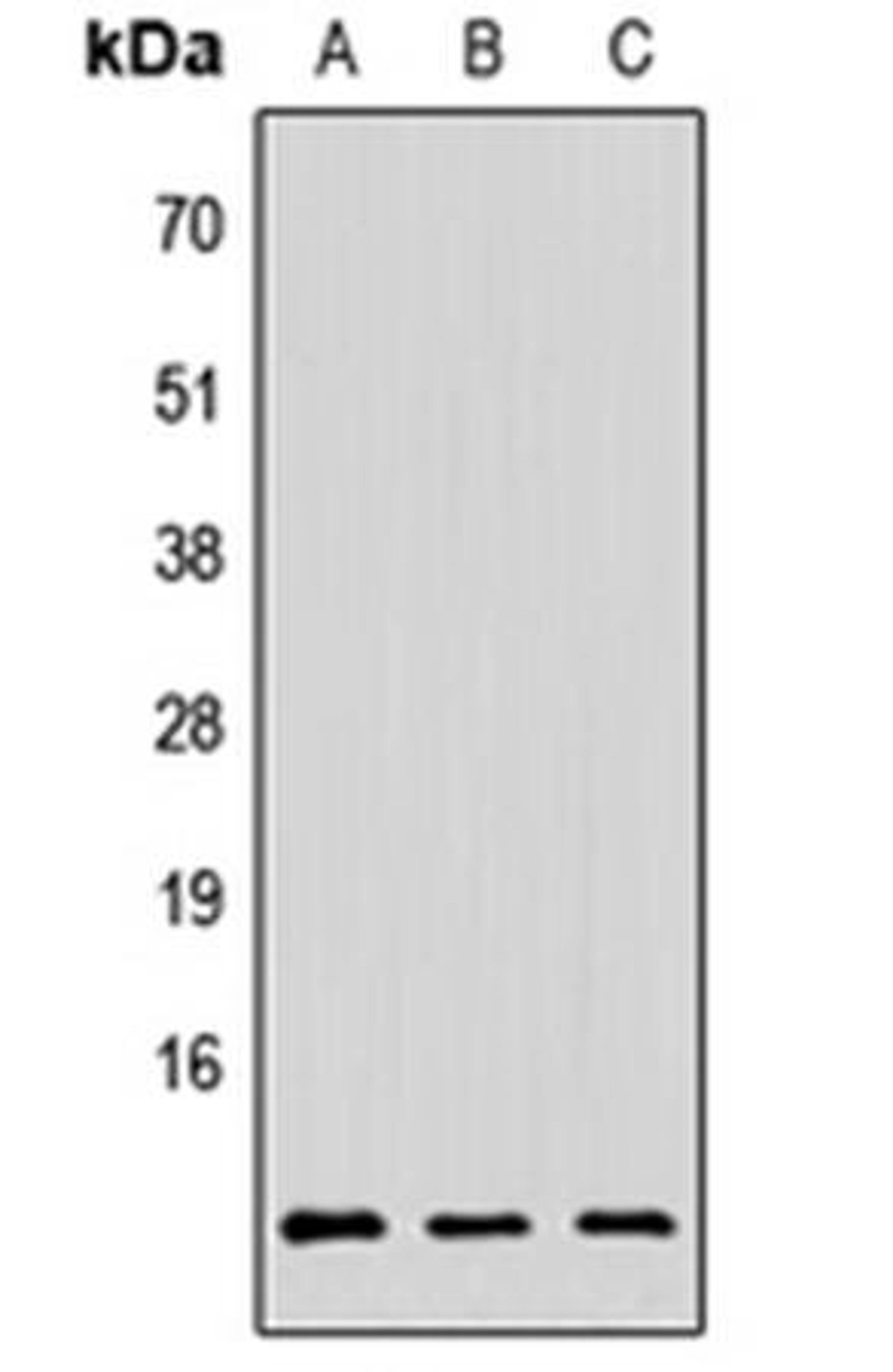 Western blot analysis of HeLa (Lane1), Raw264.7 (Lane2), H9C2 (Lane3) whole cell using PAGE3 antibody