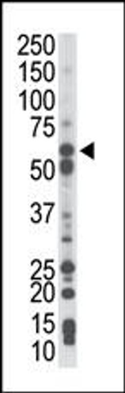 Antibody is used in Western blot to detect PCK1 in mouse liver tissue lysate.