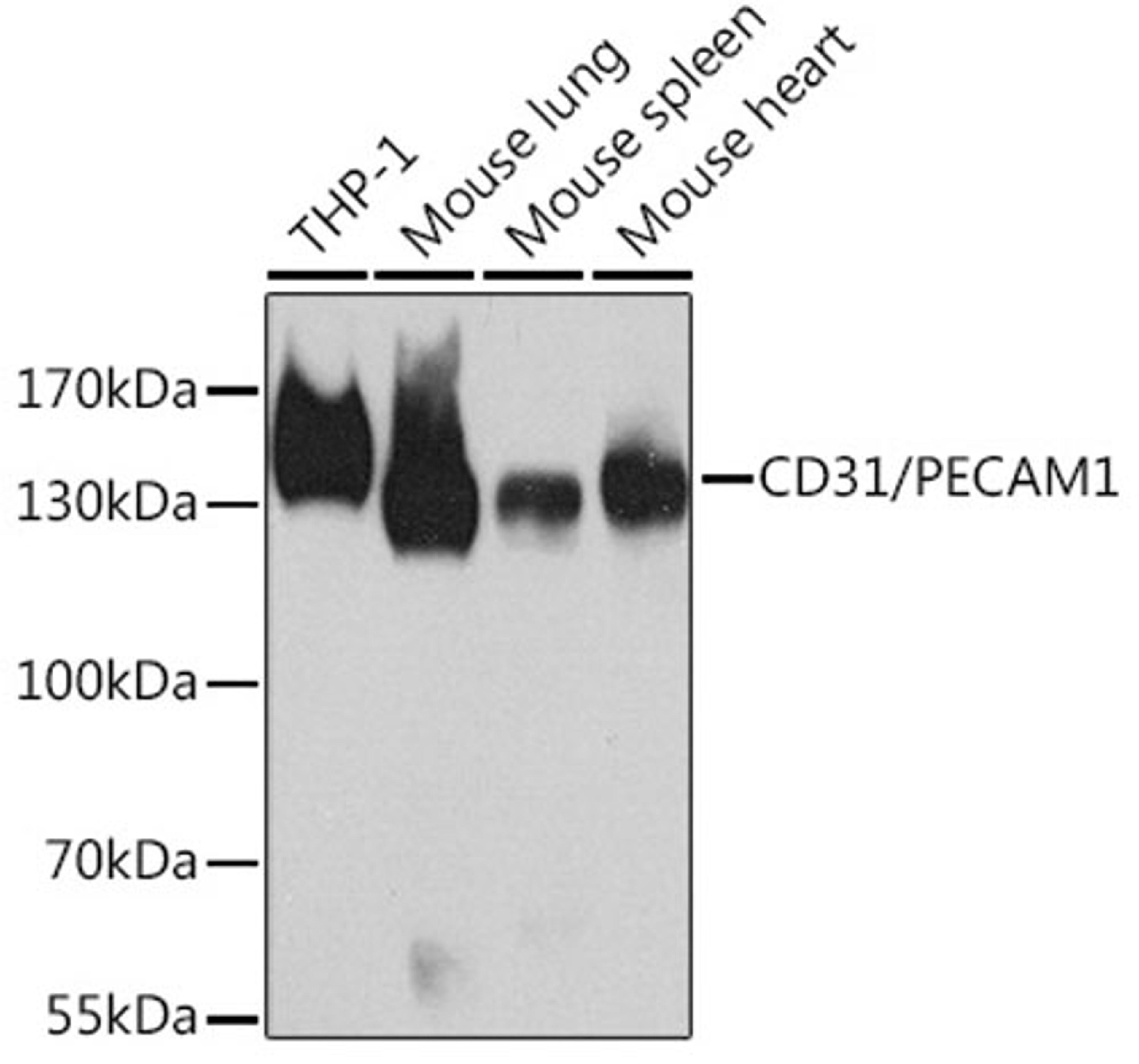 Western blot - CD31/PECAM1 antibody (A11525)