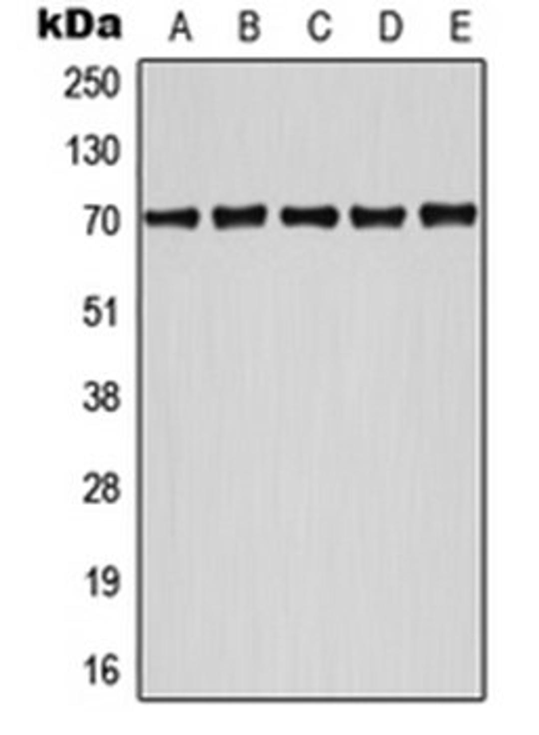 Western blot analysis of HeLa UV-treated (Lane 1), Jurkat (Lane 2), NIH3T3 (Lane 3), SP2/0 UV-treated (Lane 4), MCF7 UV-treated (Lane 5) whole cell lysates using ATF2 antibody