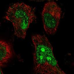 Immunocytochemistry/Immunofluorescence: MAGEE2 Antibody [NBP1-81764] - Staining of human cell line U-251MG shows positivity in nucleus & nucleoli.