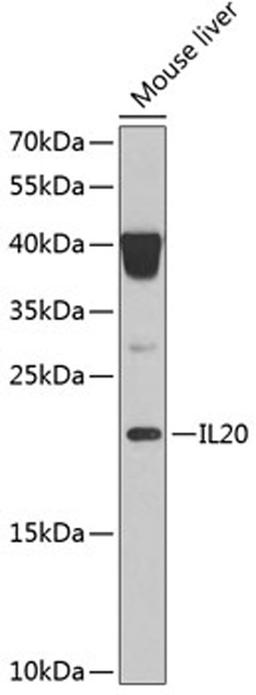 Western blot - IL20 Antibody (A6629)