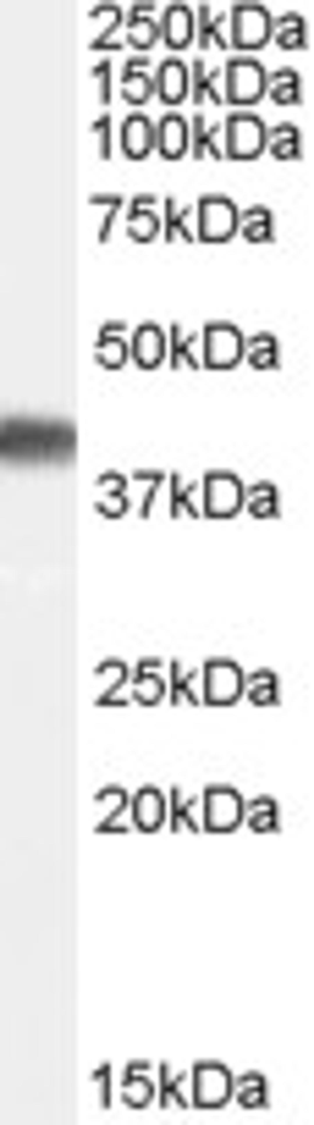 46-209 (0.1ug/ml) staining of Human Brain (Frontal Cortex) lysate (35ug protein in RIPA buffer). Primary incubation was 1 hour. Detected by chemiluminescence.