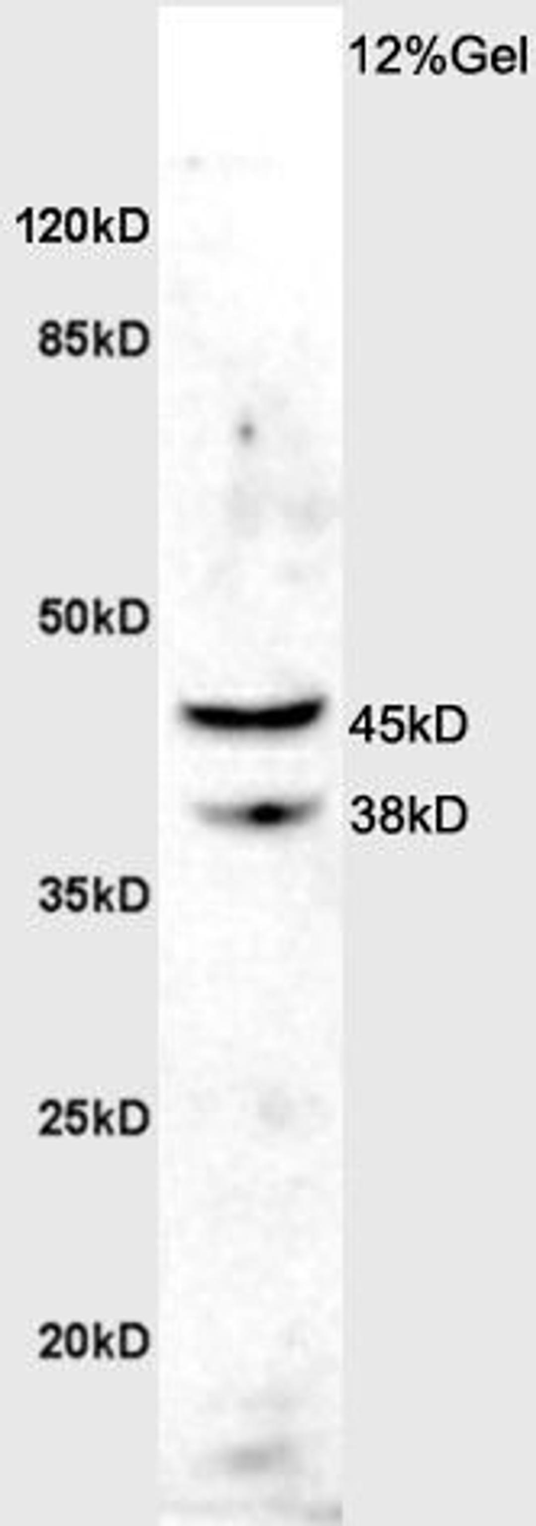 Western blot analysis of rat brain lysates using ASMTY antibody