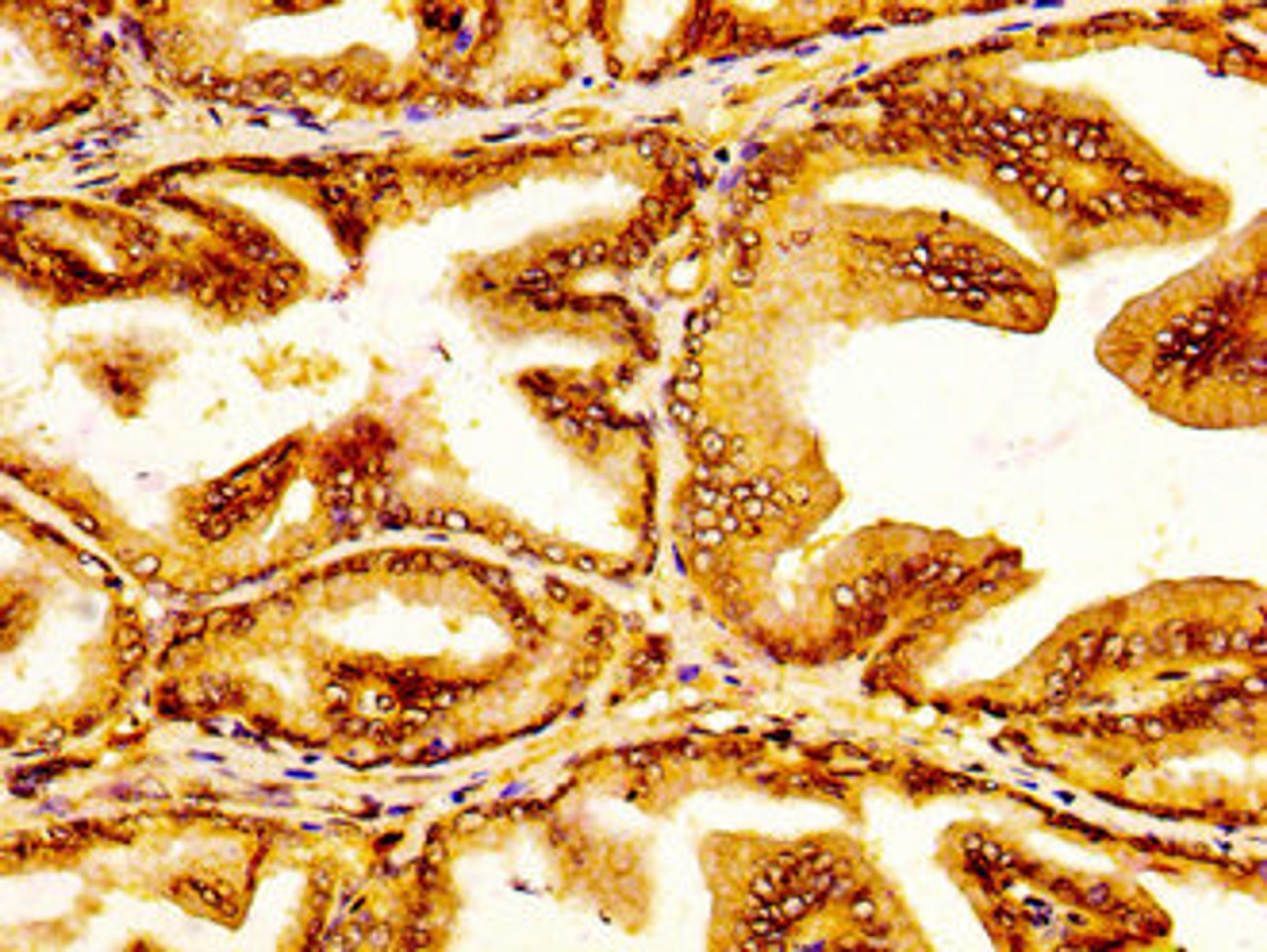 IHC image of CSB-PA836239LA01HU diluted at 1:300 and staining in paraffin-embedded human prostate tissue performed on a Leica BondTM system. After dewaxing and hydration, antigen retrieval was mediated by high pressure in a citrate buffer (pH 6.0). Section was blocked with 10% normal goat serum 30min at RT. Then primary antibody (1% BSA) was incubated at 4°C overnight. The primary is detected by a biotinylated secondary antibody and visualized using an HRP conjugated SP system.