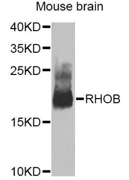 Western blot - RHOB Antibody (A2819)