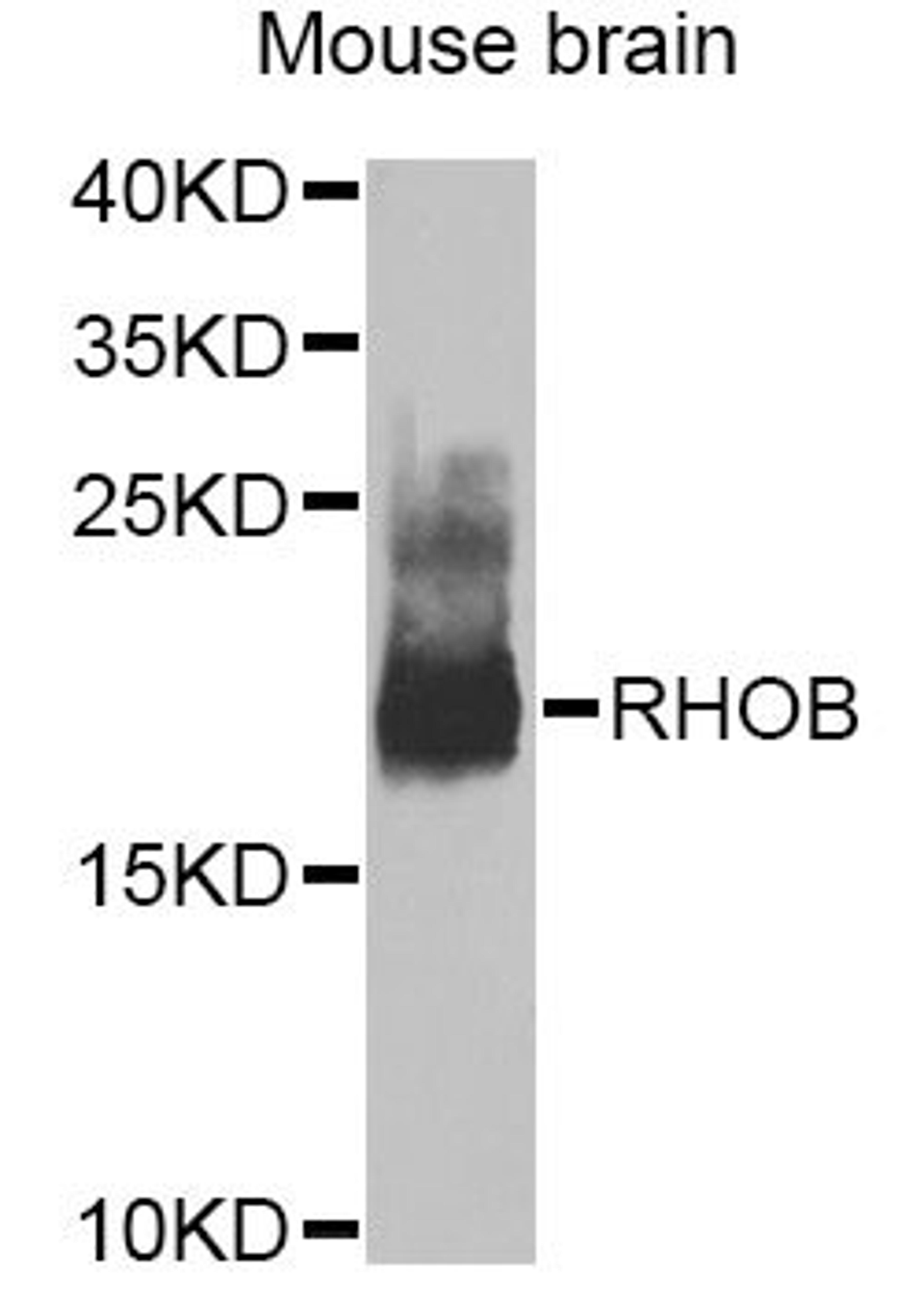 Western blot - RHOB Antibody (A2819)