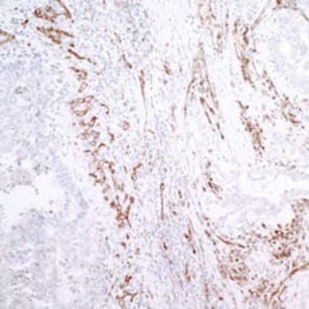 Detection of human CD31/PECAM-1 by immunohistochemistry.
