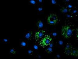 Immunocytochemistry/Immunofluorescence: MMAA Antibody (3G5) [NBP2-03496] Staining of COS7 cells transiently transfected by pCMV6-ENTRY MMAA.