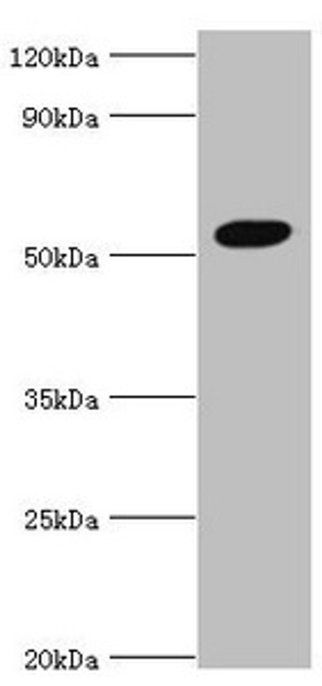Western blot. All lanes: Zinc finger protein AEBP2 antibody at 4ug/ml + Hela whole cell lysate. Secondary. Goat polyclonal to rabbit IgG at 1/10000 dilution. Predicted band size: 55, 53, 34 kDa. Observed band size: 55 kDa. 