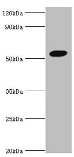 Western blot. All lanes: Zinc finger protein AEBP2 antibody at 4ug/ml + Hela whole cell lysate. Secondary. Goat polyclonal to rabbit IgG at 1/10000 dilution. Predicted band size: 55, 53, 34 kDa. Observed band size: 55 kDa. 