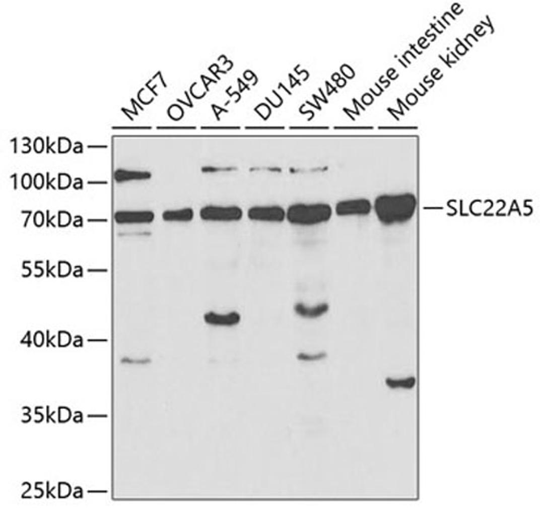 Western blot - SLC22A5 antibody (A1676)