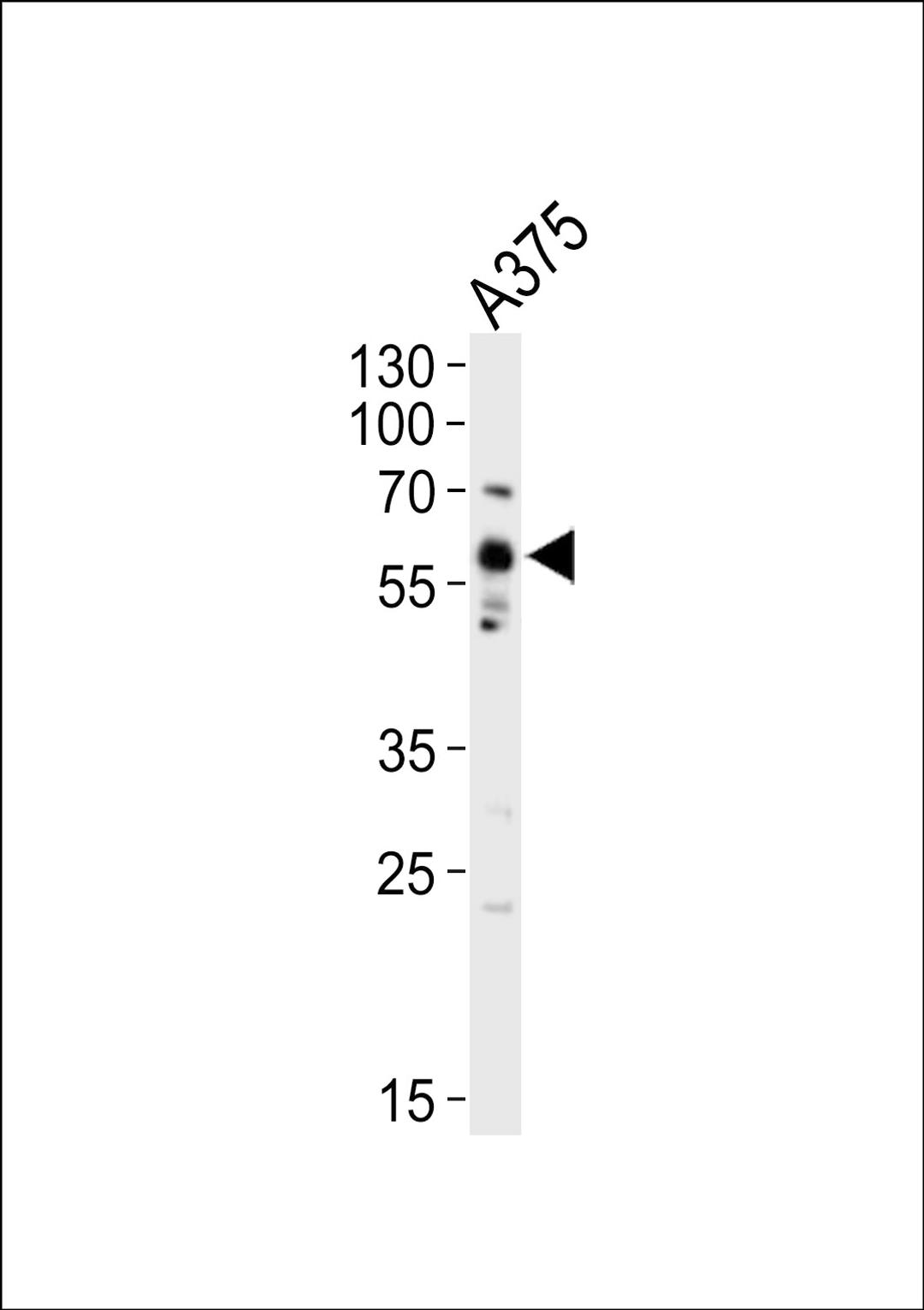 Western blot analysis of lysate from A375 cell line, using SRC Antibody (Y419) at 1:1000.