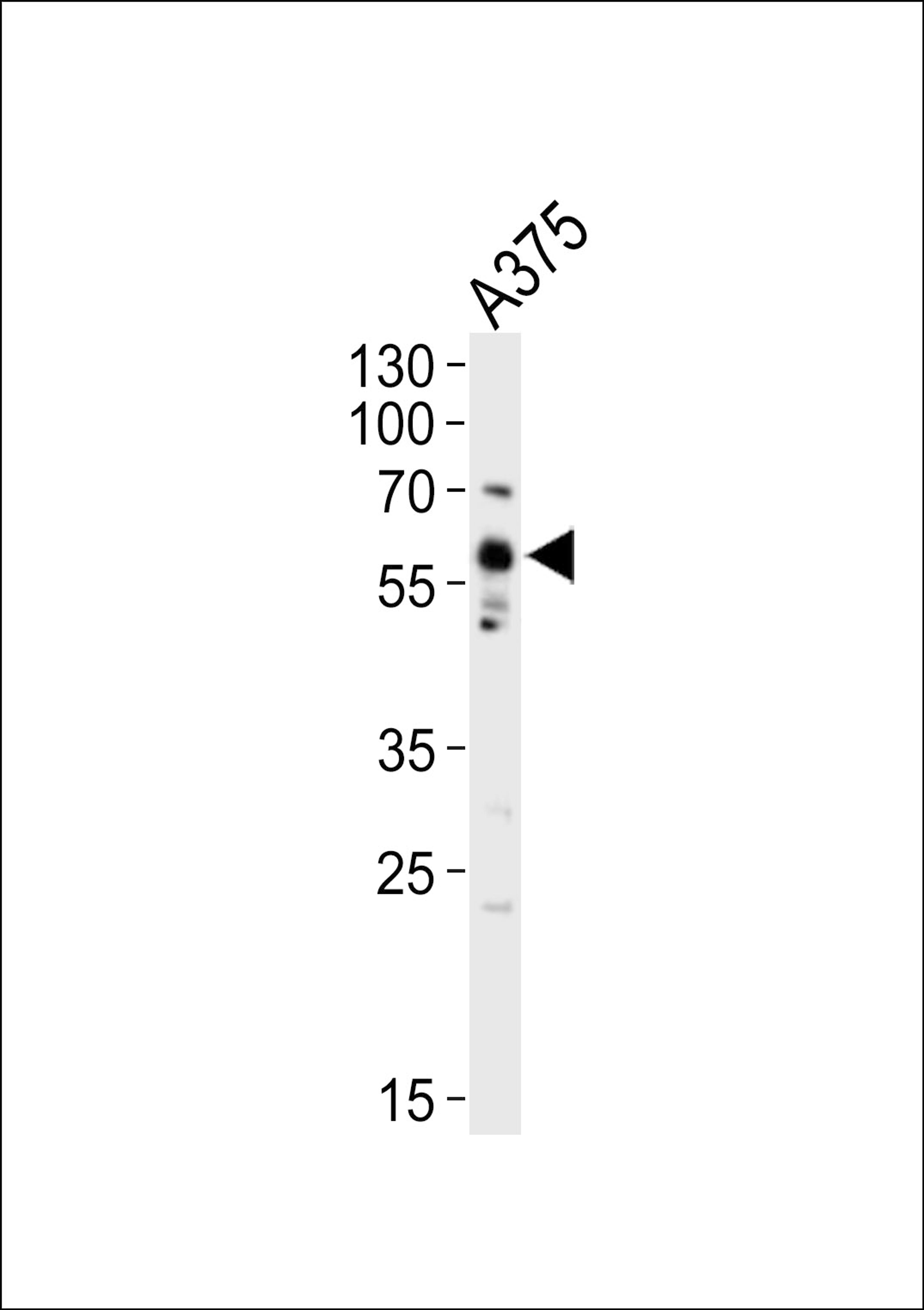 Western blot analysis of lysate from A375 cell line, using SRC Antibody (Y419) at 1:1000.