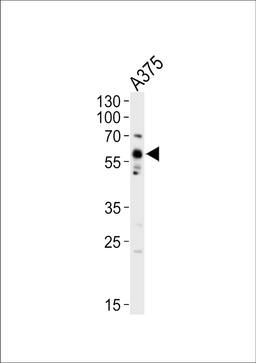 Western blot analysis of lysate from A375 cell line, using SRC Antibody (Y419) at 1:1000.