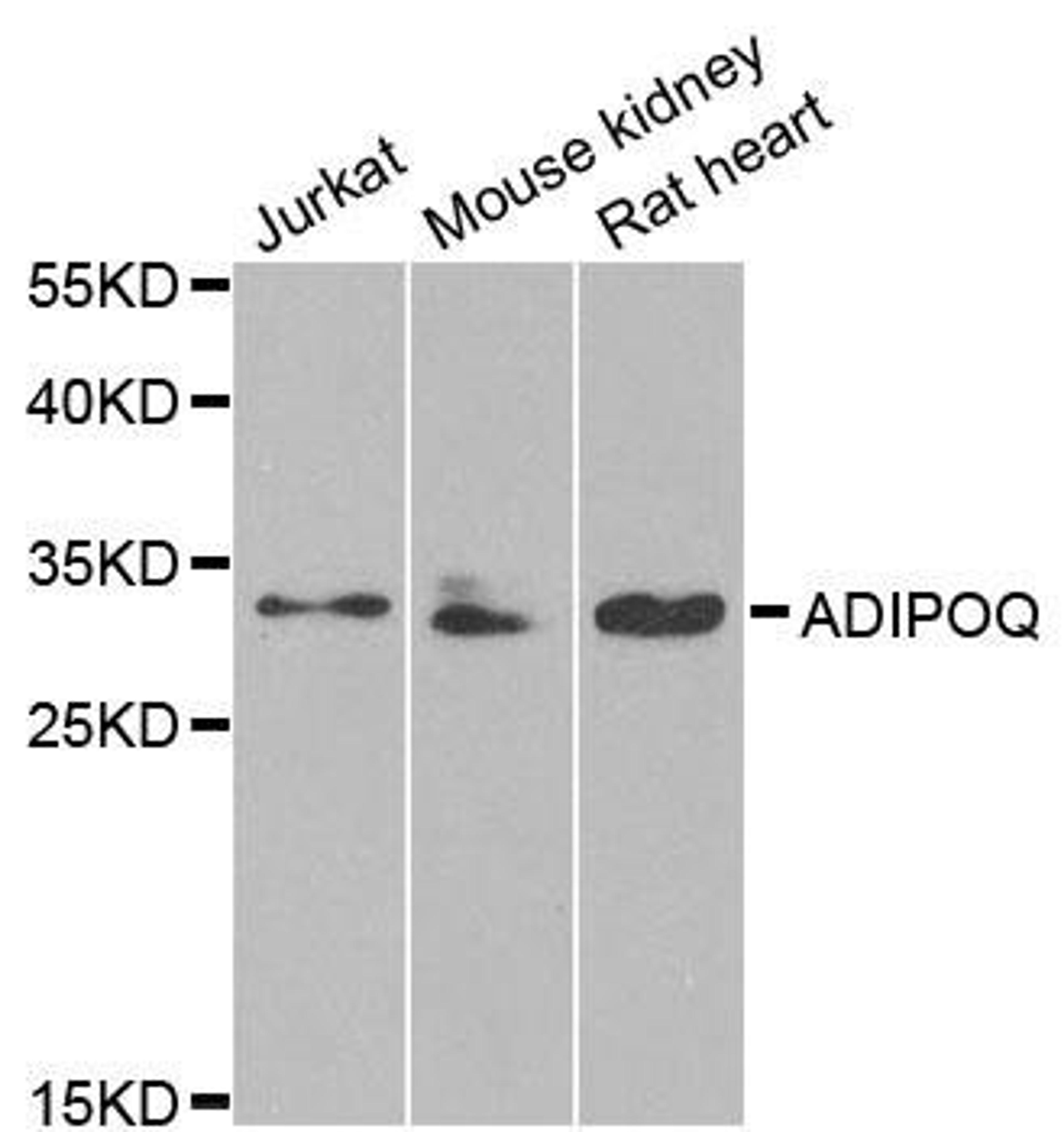 Western blot analysis of extracts of various cell lines using ADIPOQ antibody