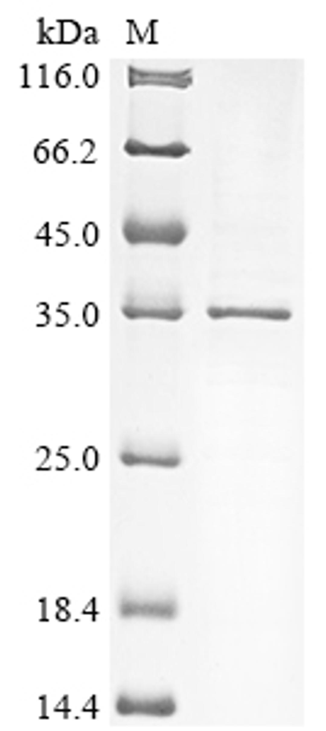 (Tris-Glycine gel) Discontinuous SDS-PAGE (reduced) with 5% enrichment gel and 15% separation gel.