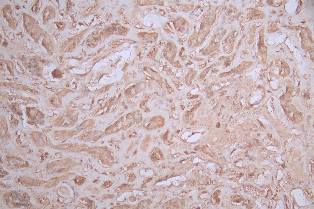IHC image of CSB-RA095825A0HU diluted at 1:100 and staining in paraffin-embedded human kidney tissue performed on a Leica BondTM system. After dewaxing and hydration, antigen retrieval was mediated by high pressure in a citrate buffer (pH 6.0). Section was blocked with 10% normal goat serum 30min at RT. Then primary antibody (1% BSA) was incubated at 4°C overnight. The primary is detected by a Goat anti-rabbit polymer IgG labeled by HRP and visualized using 0.56% DAB.