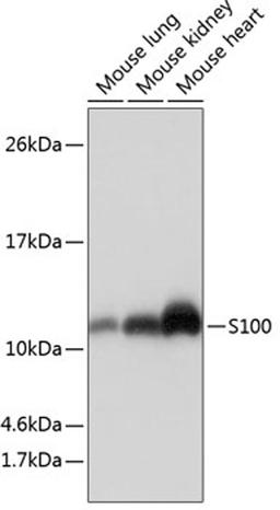 Western blot - S100 antibody (A19107)