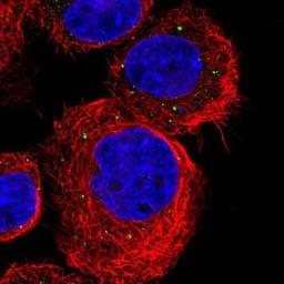 Immunocytochemistry/Immunofluorescence: TMEM234 Antibody [NBP1-90701] - Staining of human cell line A-431 shows positivity in vesicles.