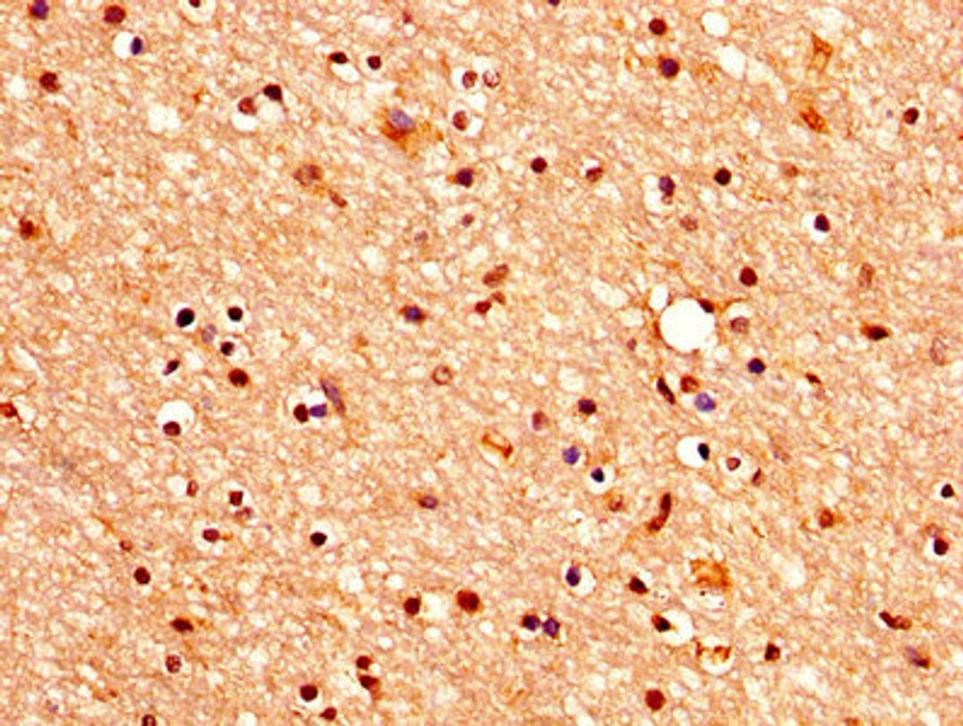 IHC image of CSB-PA005383LA01HU diluted at 1:400 and staining in paraffin-embedded human brain tissue performed on a Leica BondTM system. After dewaxing and hydration, antigen retrieval was mediated by high pressure in a citrate buffer (pH 6.0). Section was blocked with 10% normal goat serum 30min at RT. Then primary antibody (1% BSA) was incubated at 4&deg;C overnight. The primary is detected by a biotinylated secondary antibody and visualized using an HRP conjugated SP system.