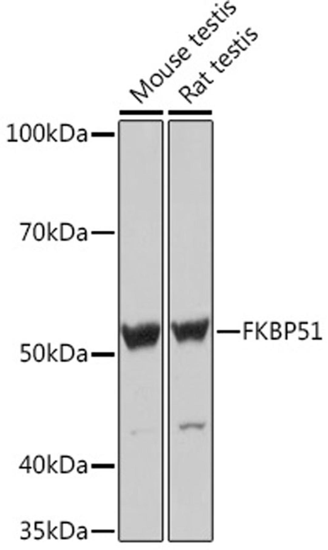 Western blot - FKBP51 Rabbit mAb (A9090)