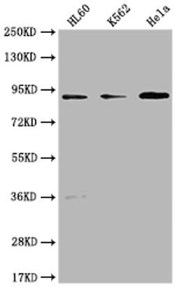 Western Blot. Positive WB detected in: HL60 whole cell lysate, K562 whole cell lysate, Hela whole cell lysate. All lanes: RPTN antibody at 1:1000. Secondary. Goat polyclonal to rabbit IgG at 1/50000 dilution. Predicted band size: 91 kDa. Observed band size: 91 kDa. 