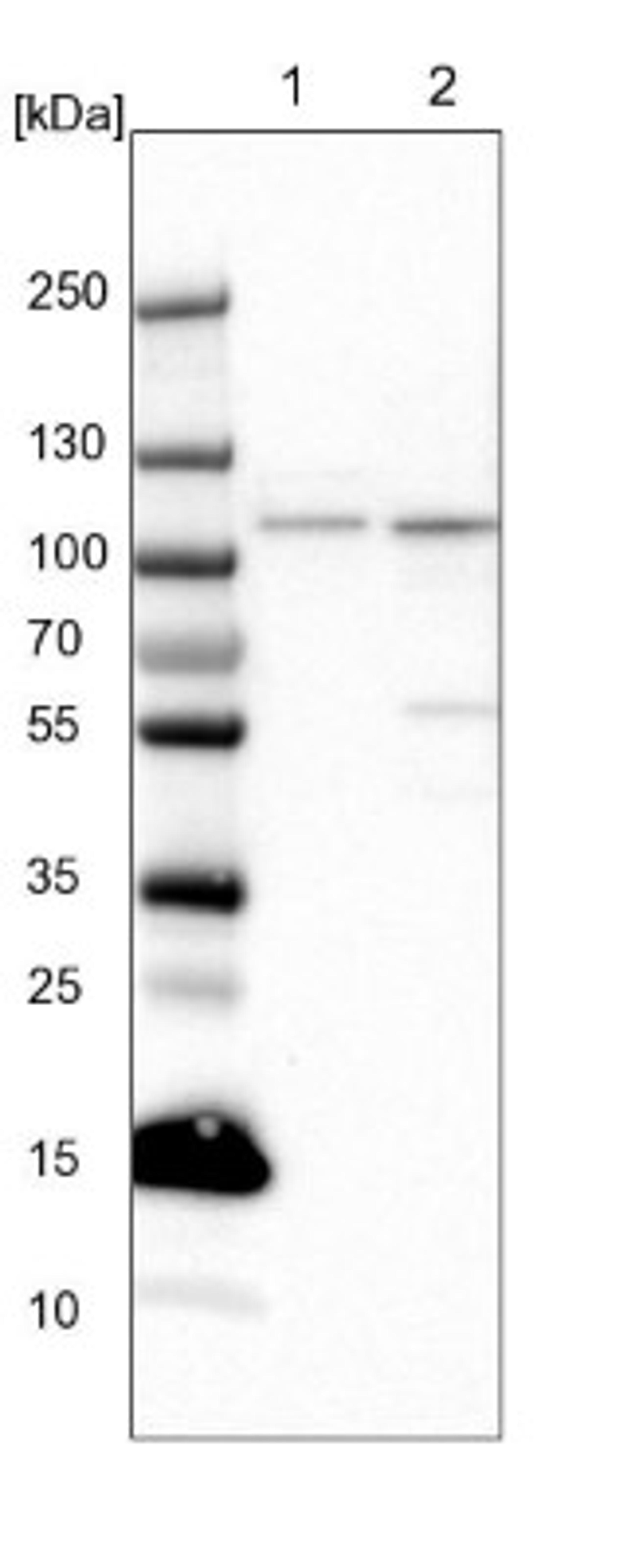 Western Blot: SMEK2 Antibody [NBP1-83882] - Lane 1: NIH-3T3 cell lysate (Mouse embryonic fibroblast cells)<br/>Lane 2: NBT-II cell lysate (Rat Wistar bladder tumour cells)