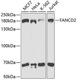 Western blot - FANCD2 antibody (A2072)