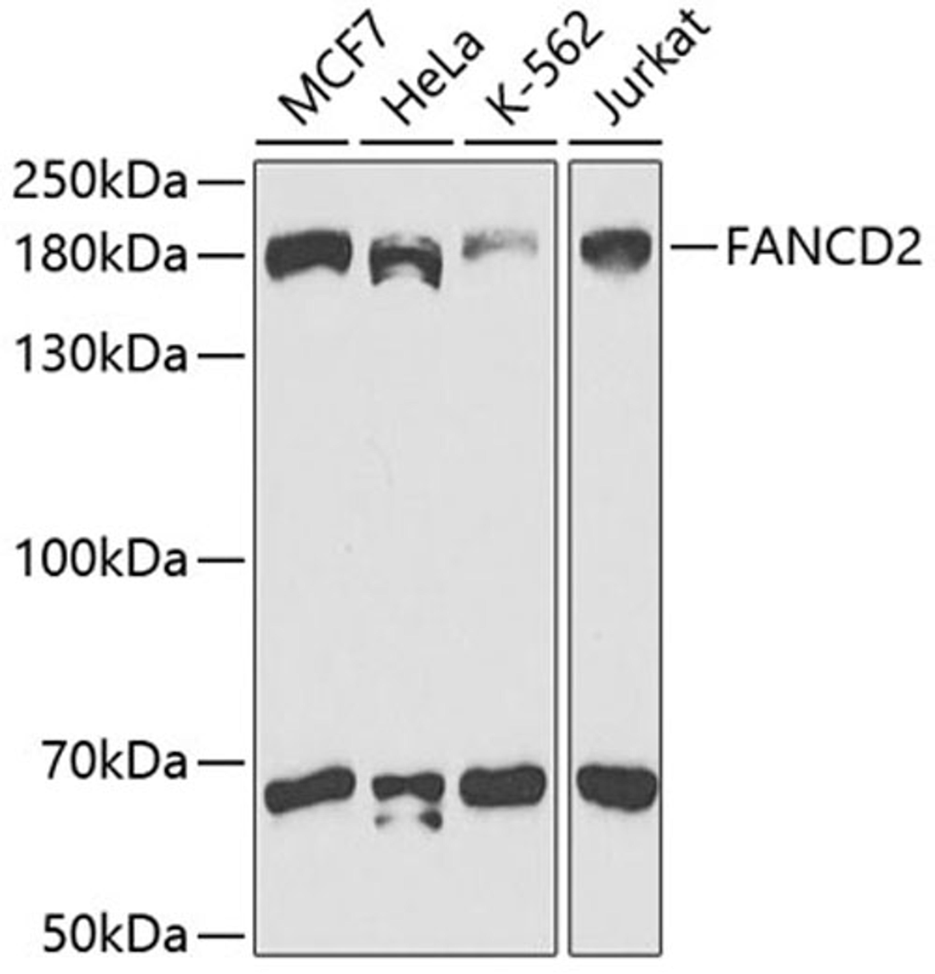 Western blot - FANCD2 antibody (A2072)