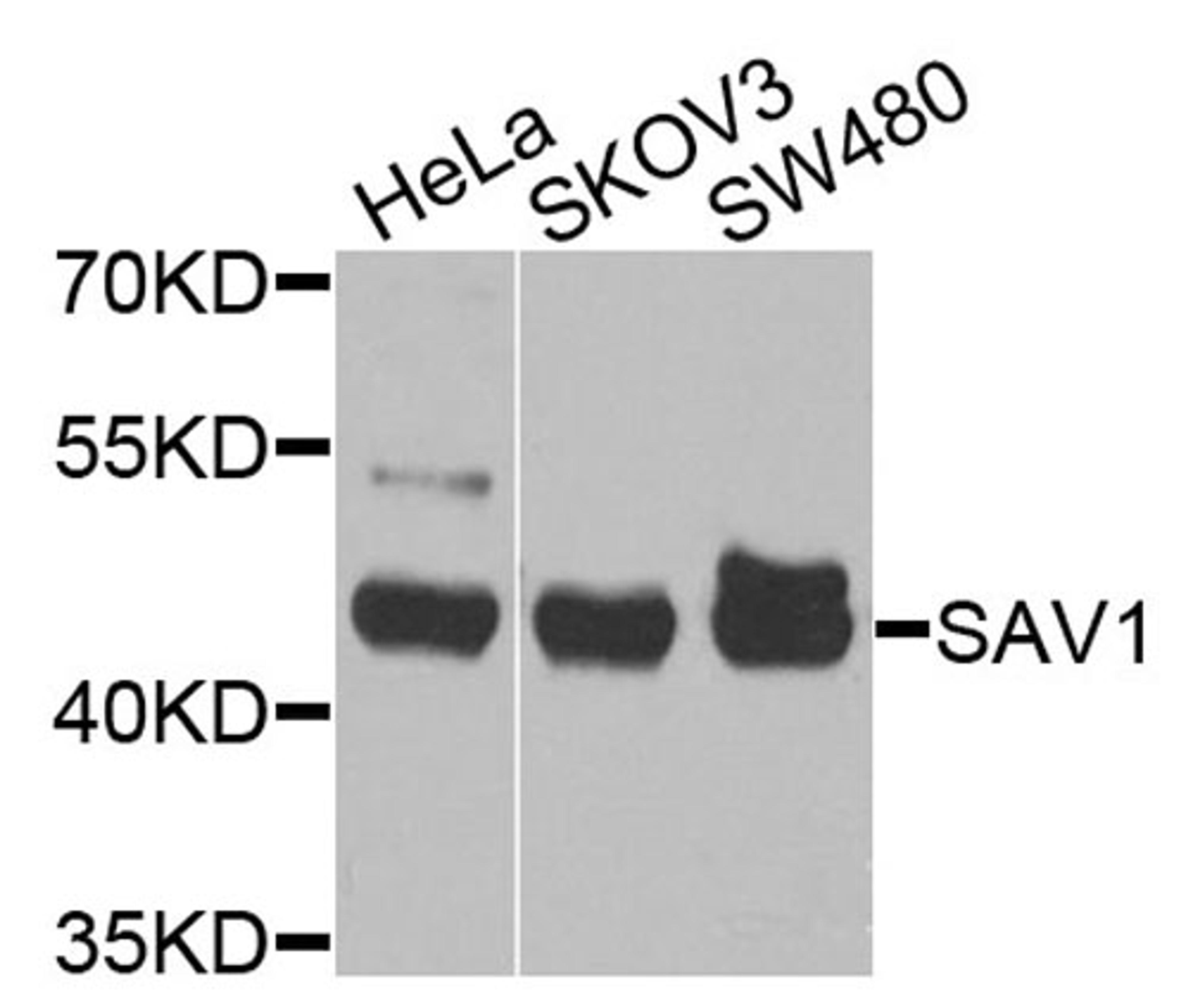 Western blot - SAV1 antibody (A9980)