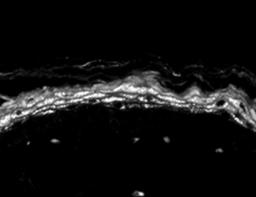 Immunohistochemistry: Nav1.8 Antibody (S134-12) [NBP1-47615] - Mouse backskin sections. Courtesy of Dr. Turksen, Ottawa Hospital Research Institute, Canada.