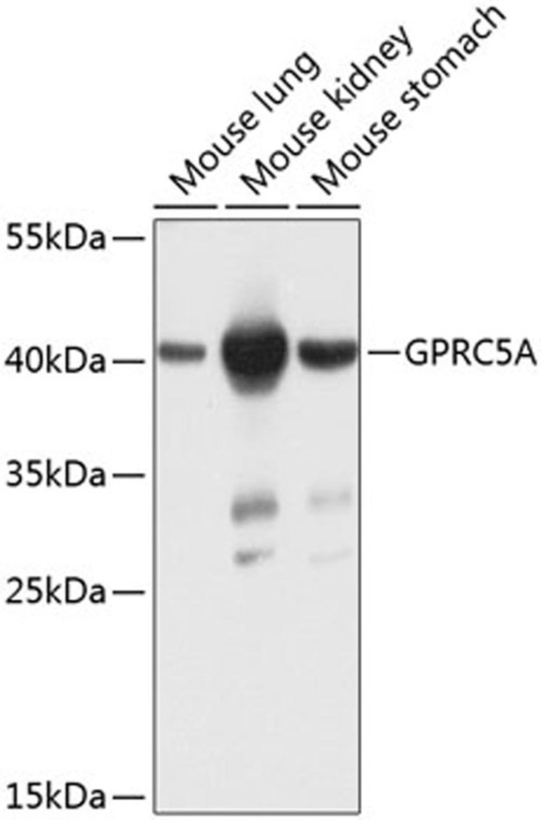 Western blot - GPRC5A antibody (A8173)