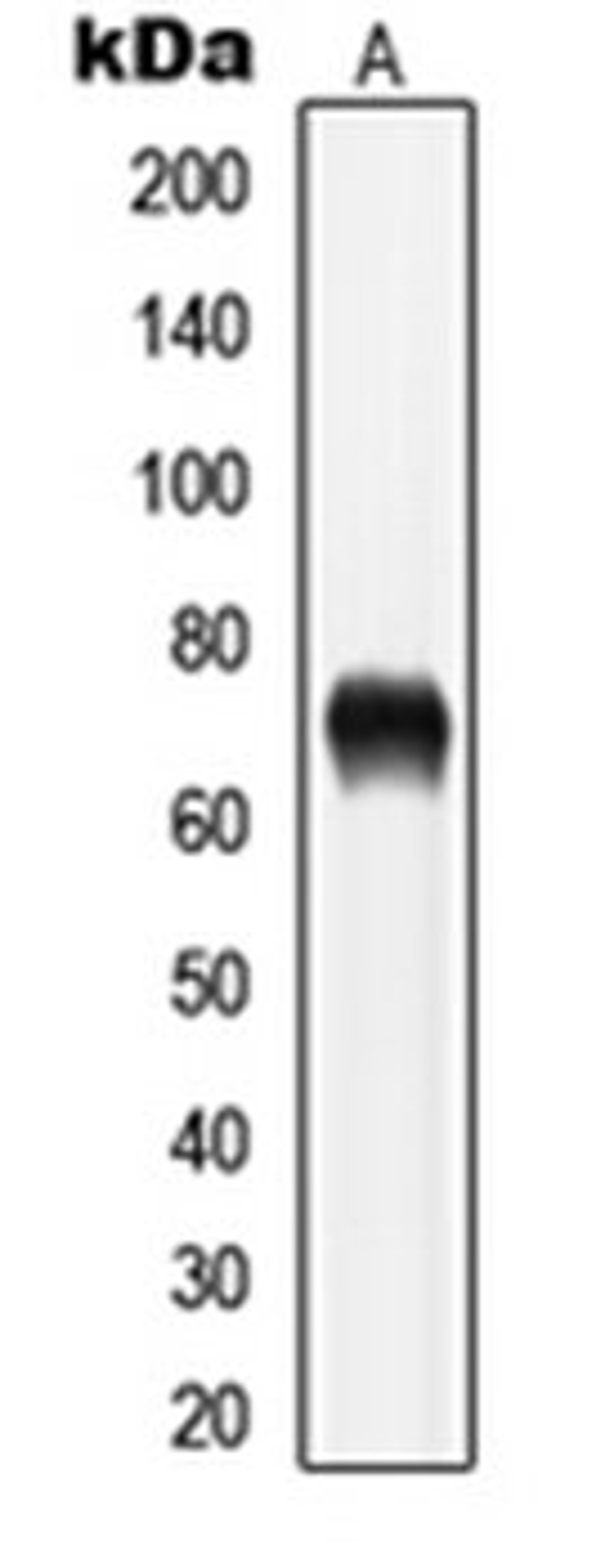 Western blot analysis of PC12 (Lane 1) whole cell lysates using LIMK1 antibody