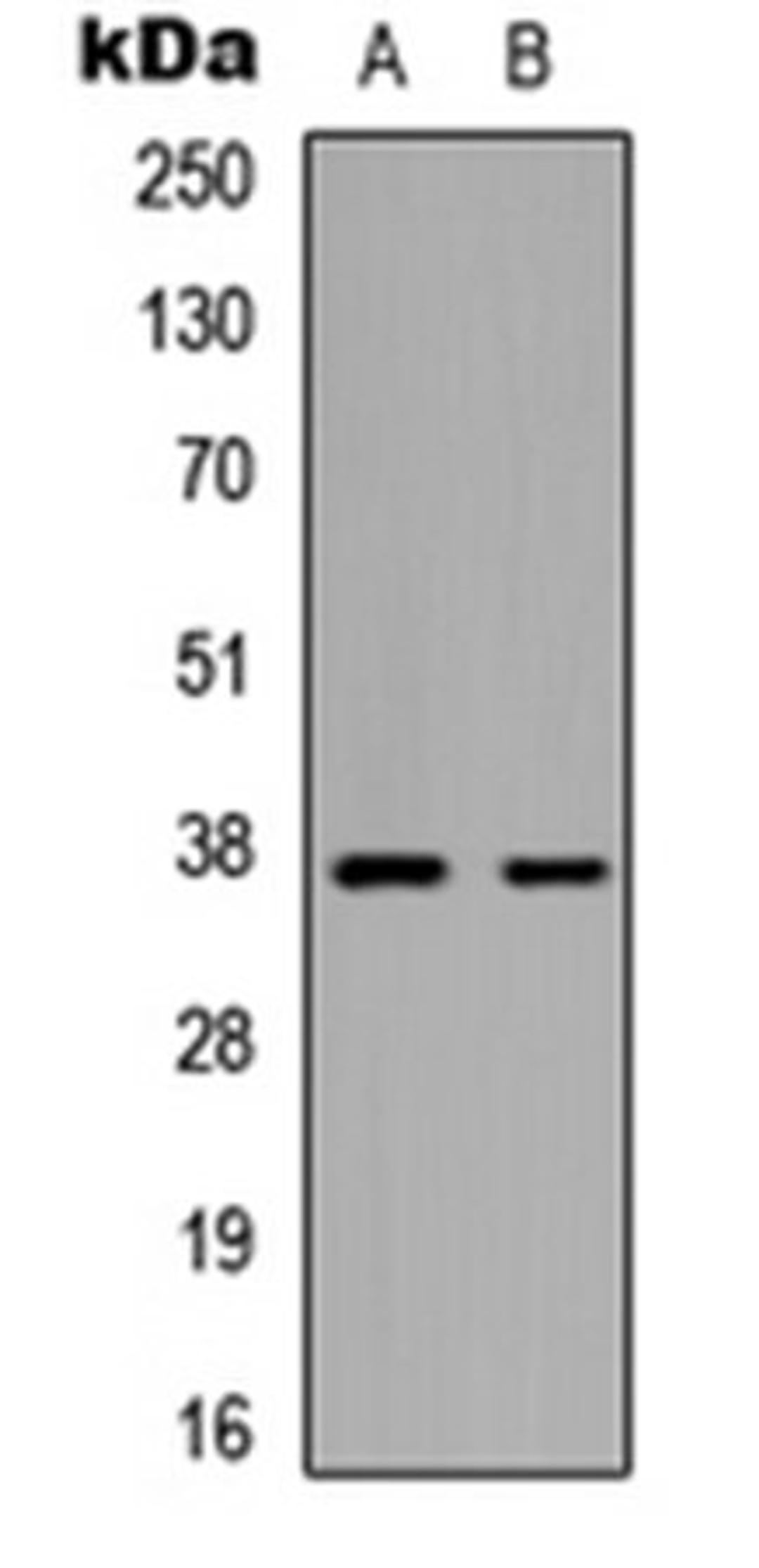 Western blot analysis of HepG2 (Lane 1), mouse brain (Lane 2) whole cell lysates using MARCH5 antibody