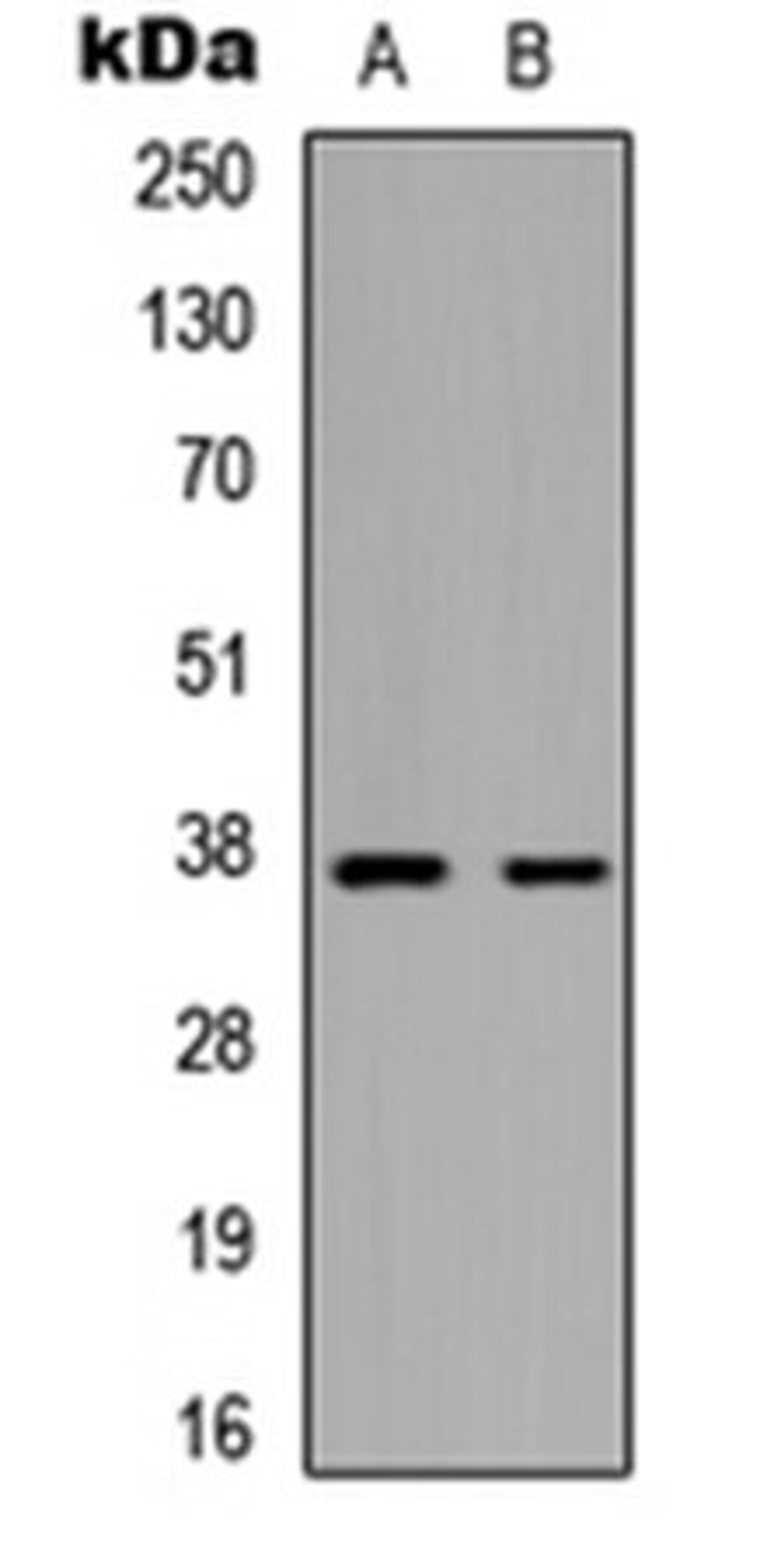 Western blot analysis of HepG2 (Lane 1), mouse brain (Lane 2) whole cell lysates using MARCH5 antibody