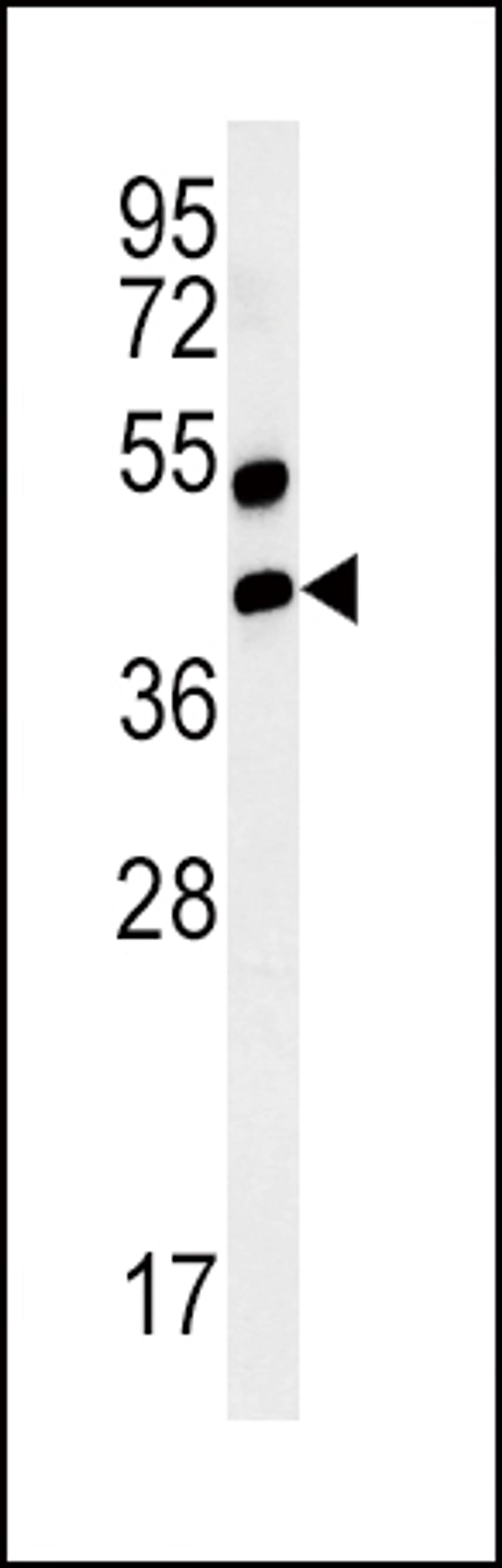 Western blot analysis of AGER-K44 in mouse lung tissue lysates (35ug/lane)