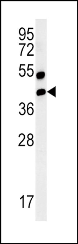 Western blot analysis of AGER-K44 in mouse lung tissue lysates (35ug/lane)