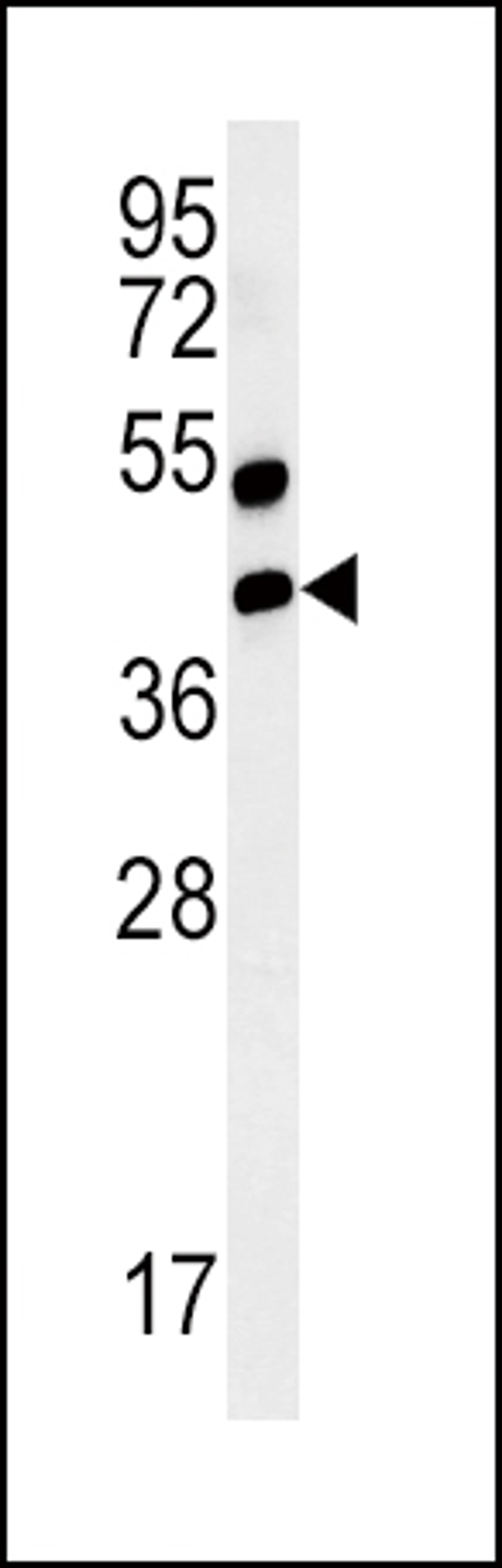 Western blot analysis of AGER-K44 in mouse lung tissue lysates (35ug/lane)