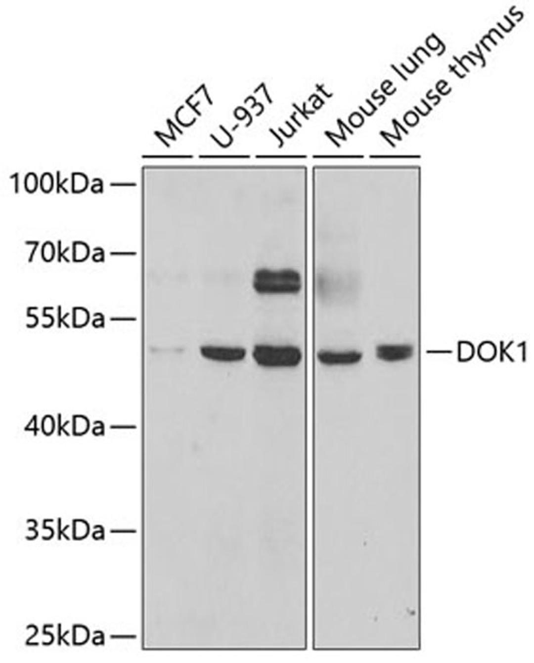 Western blot - DOK1 antibody (A5687)