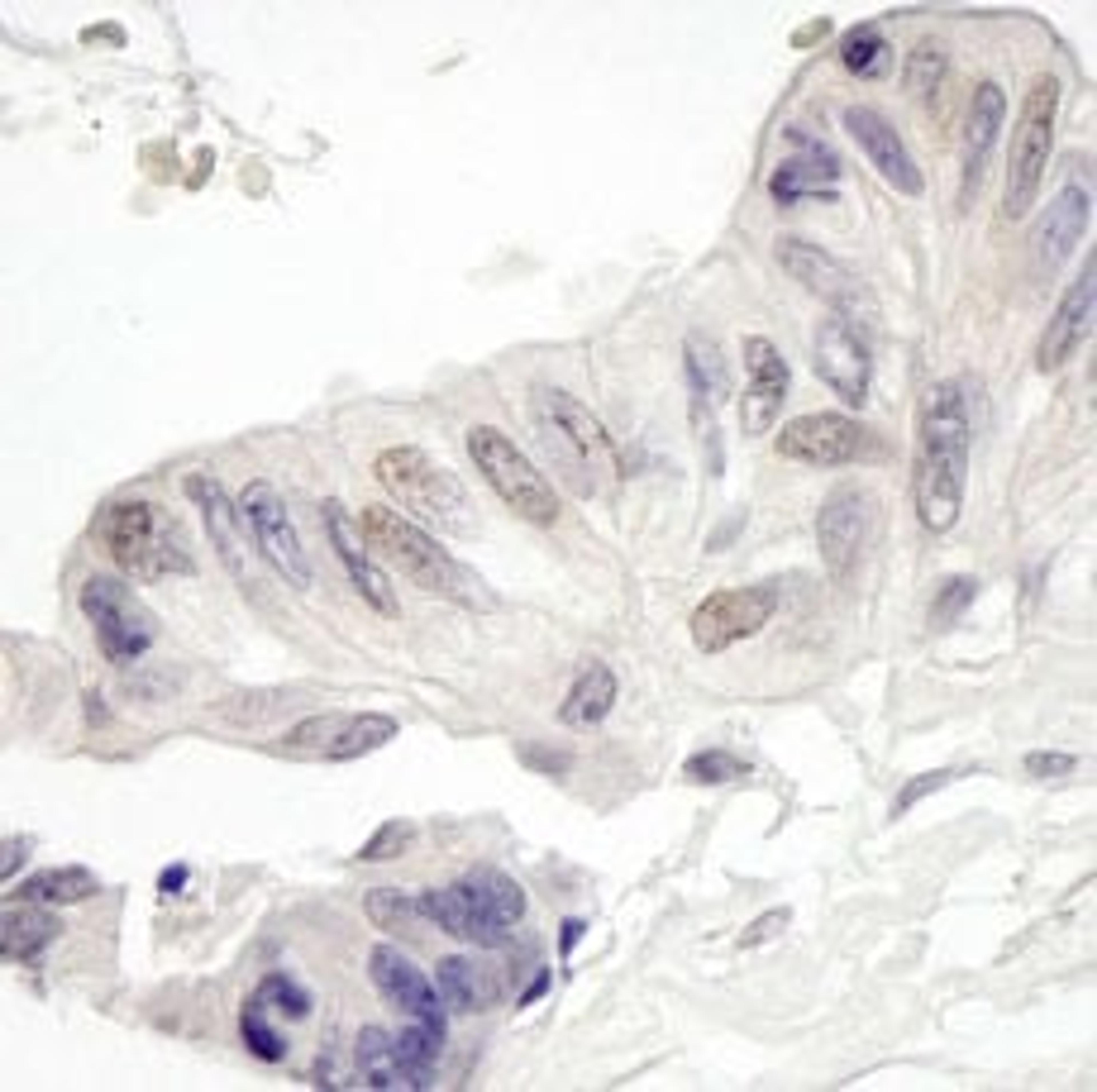 Detection of human MAML1 by immunohistochemistry.