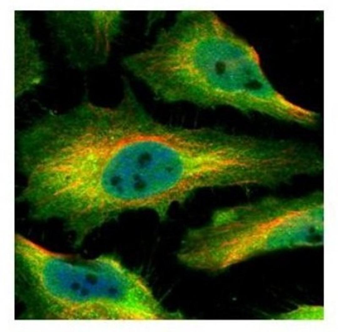 Immunocytochemistry/Immunofluorescence: SmyD1 Antibody [NBP2-20428] - Confocal immunofluorescence analysis of paraformaldehyde-fixed HeLa, using SMYD1 antibody (Green) at 1:500 dilution. Alpha-tubulin filaments are labeled with Alpha-tubulin antibody (Red) at 1:2000.