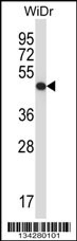 Western blot analysis in WiDr cell line lysates (35ug/lane).