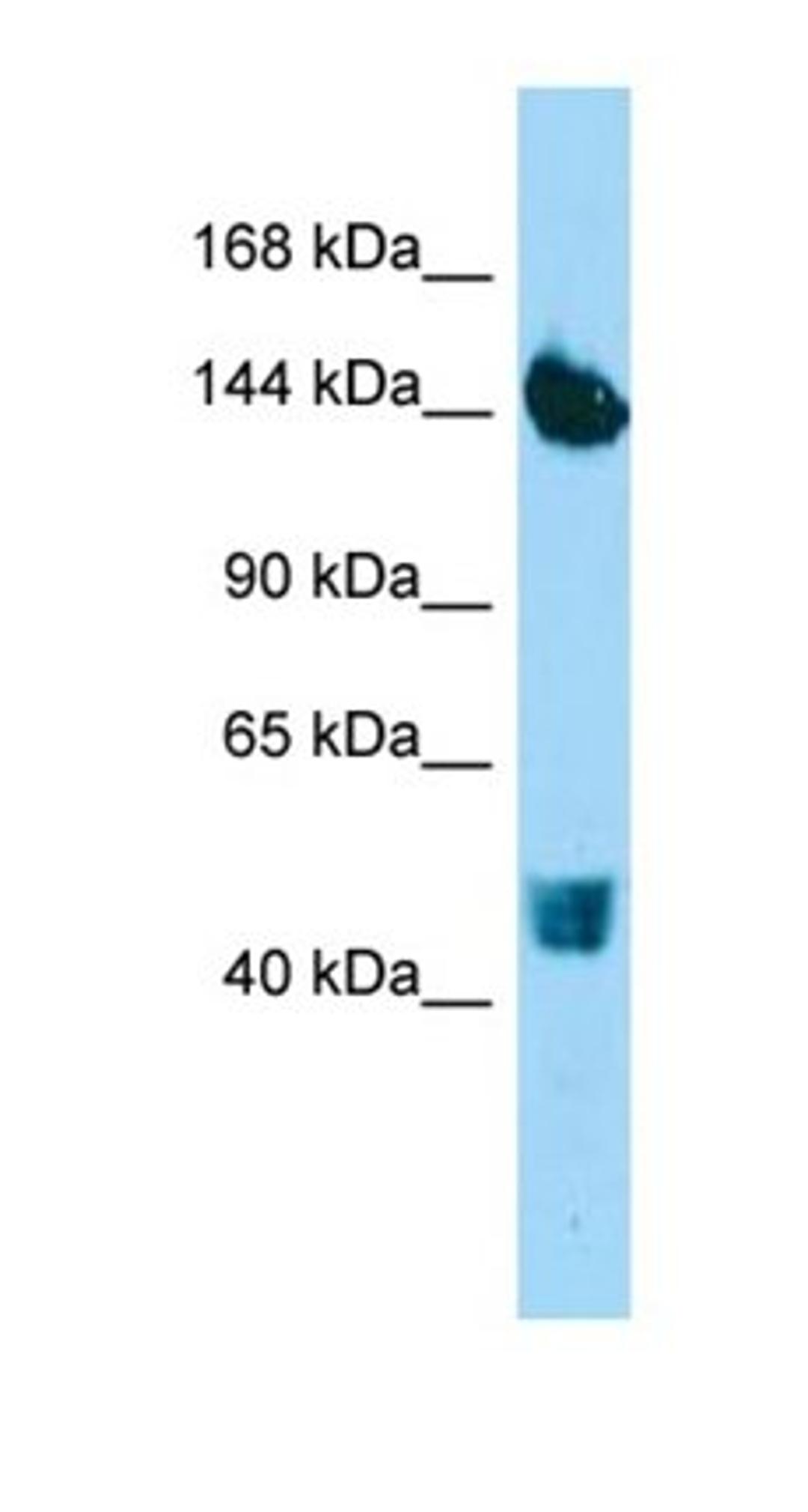 Western blot analysis of human HepG2 tissue using COL22A1 antibody