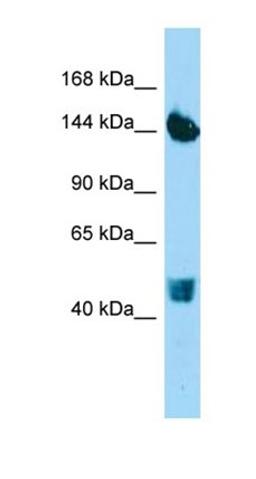 Western blot analysis of human HepG2 tissue using COL22A1 antibody