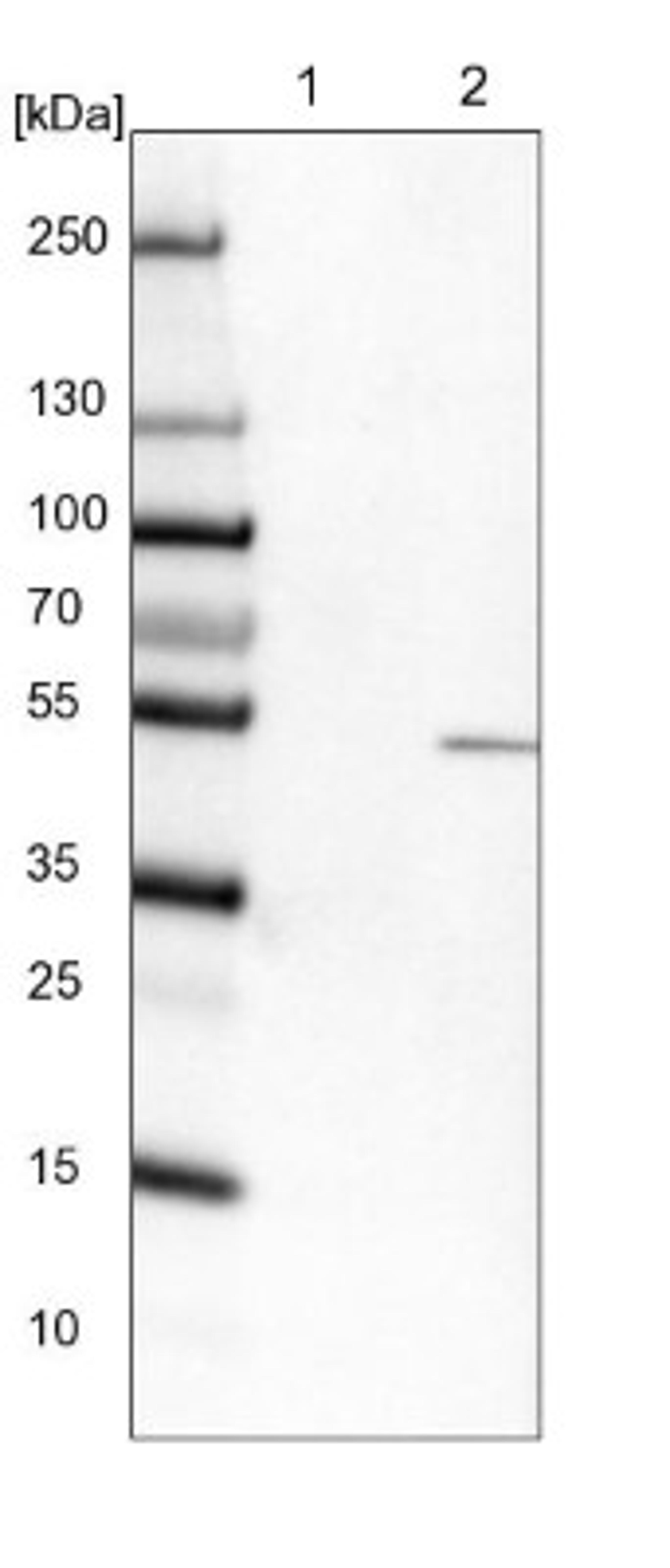 Western Blot: TYSND1 Antibody [NBP1-93484] - Lane 1: NIH-3T3 cell lysate (Mouse embryonic fibroblast cells)<br/>Lane 2: NBT-II cell lysate (Rat Wistar bladder tumour cells)