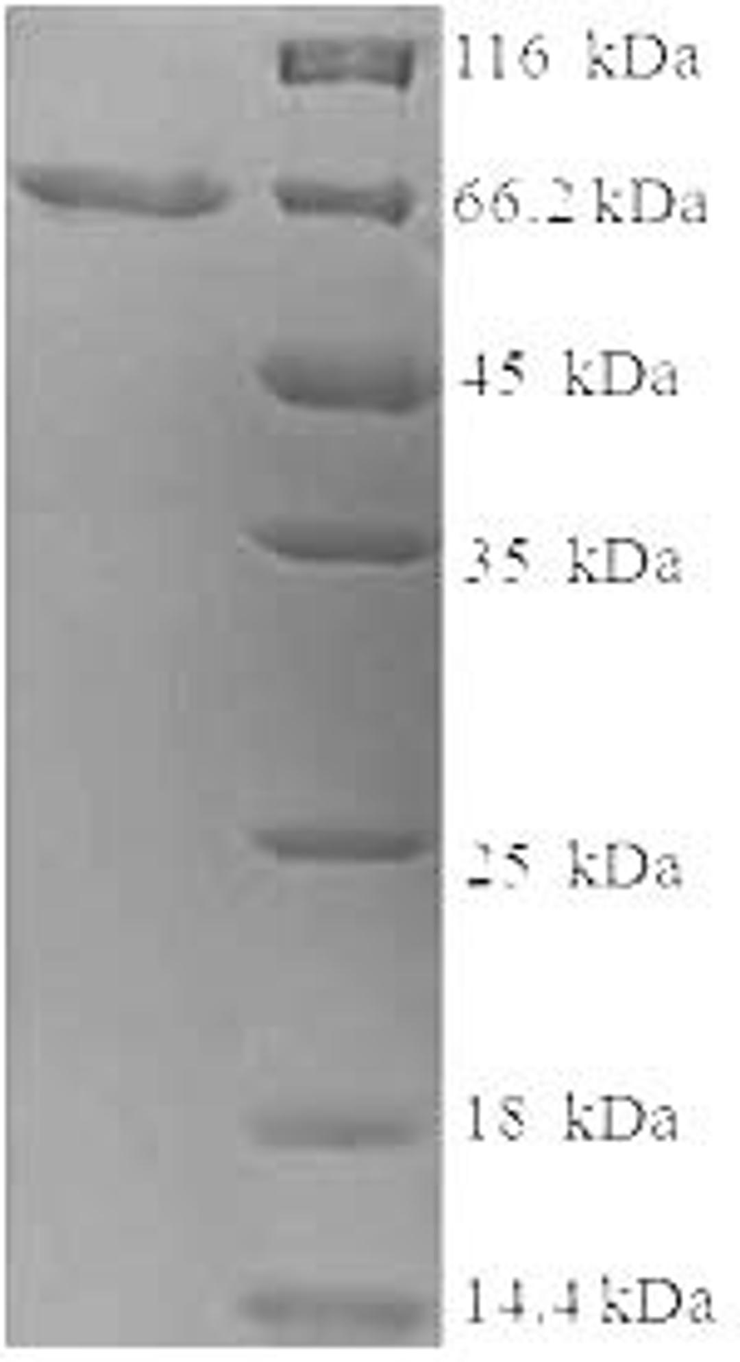 (Tris-Glycine gel) Discontinuous SDS-PAGE (reduced) with 5% enrichment gel and 15% separation gel.