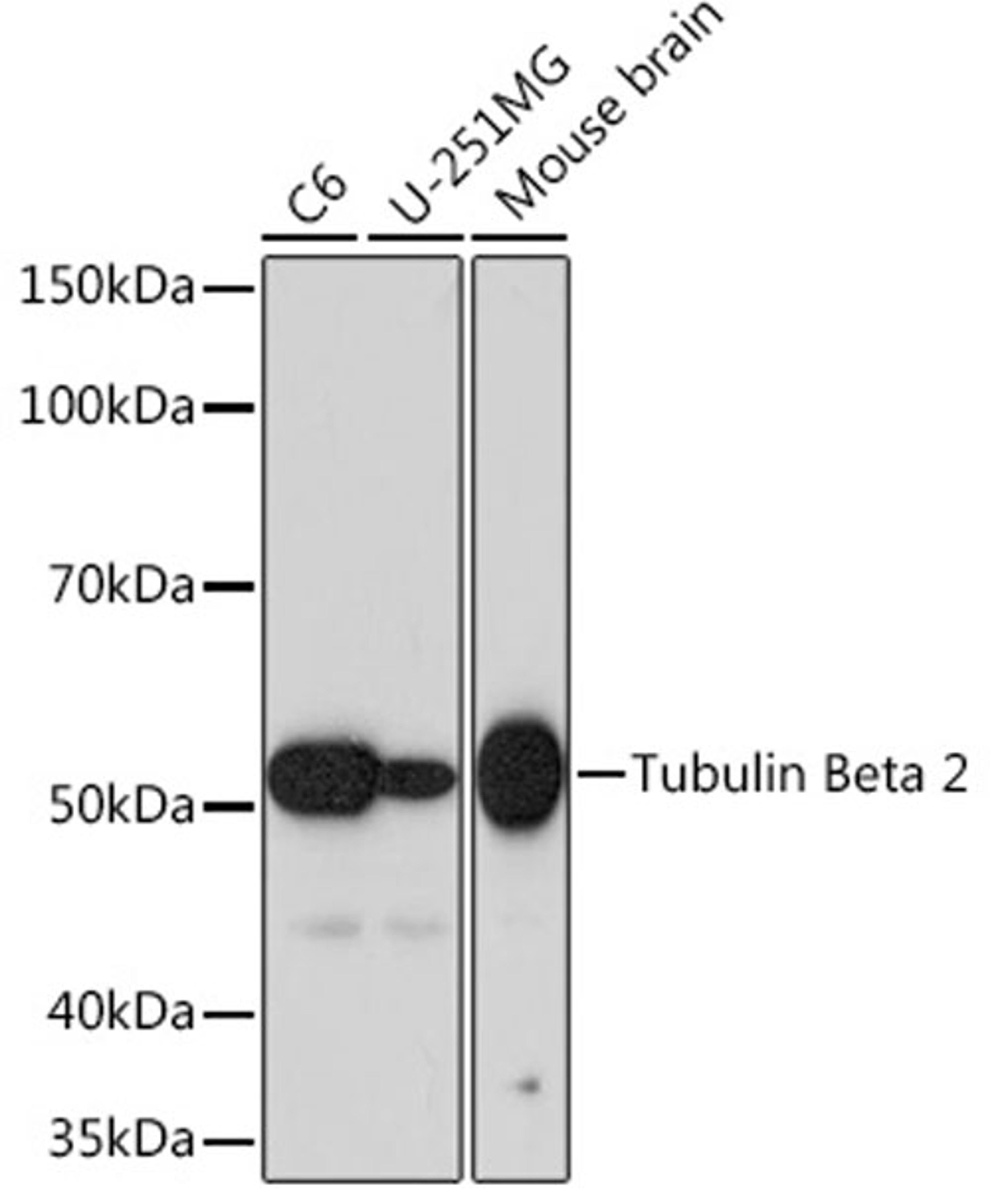 Western blot - Tubulin Beta 2 Rabbit mAb (A4798)