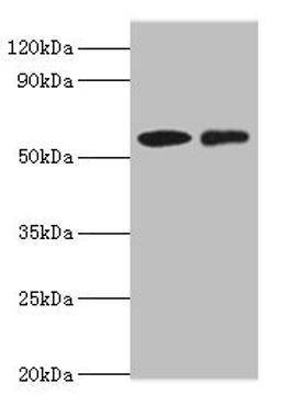 Western blot. All lanes: CARD9 antibody at 15ug/ml. Lane 1: THP-1 whole cell lysate. Lane 2: Jurkat whole cell lysate. Secondary. Goat polyclonal to rabbit IgG at 1/10000 dilution. Predicted band size: 63, 57, 43 kDa. Observed band size: 63 kDa. 